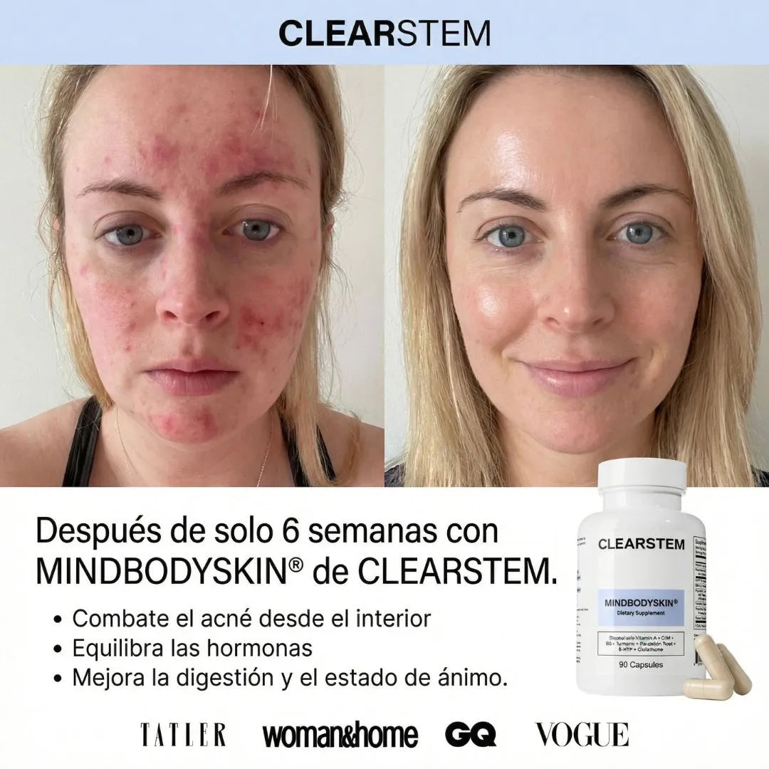 MindBodySkin -Clearstem | Piel libre de acné hormonal