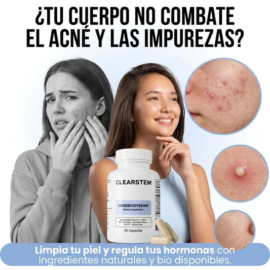 MindBodySkin -Clearstem | Piel libre de acné hormonal