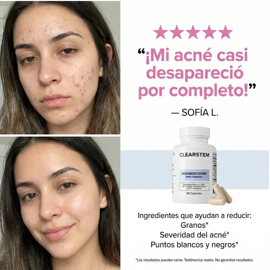 MindBodySkin -Clearstem | Piel libre de acné hormonal