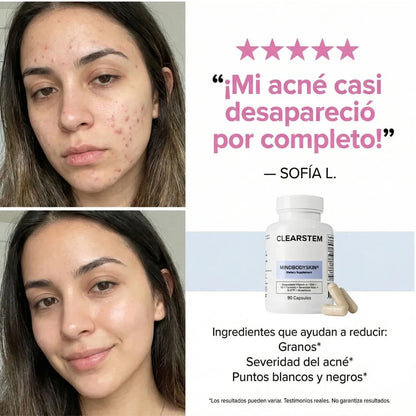 MindBodySkin -Clearstem | Piel libre de acné hormonal